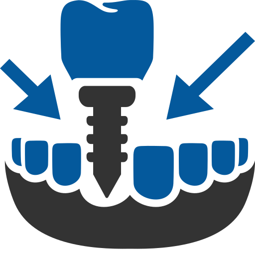 Dental Implant
