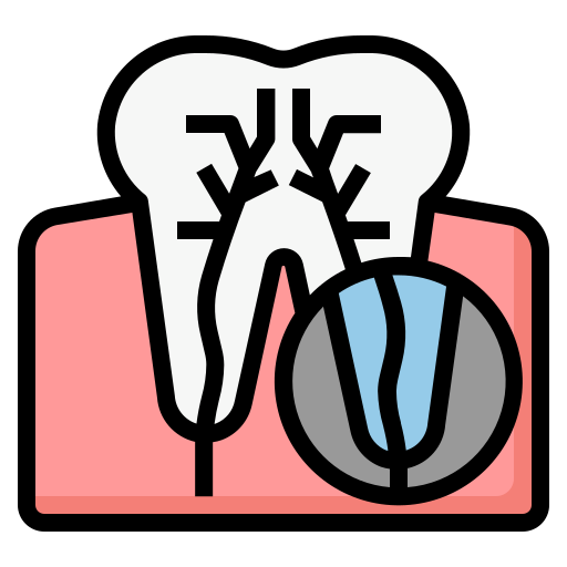 Root Canal